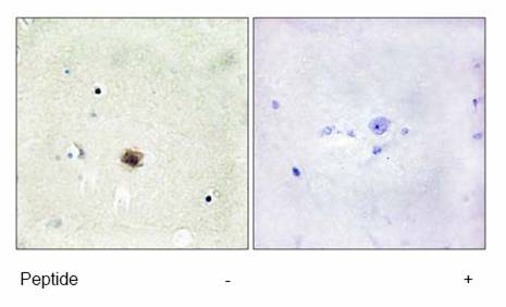 Immunohistochemistry (Formalin/PFA-fixed paraffin-embedded sections) - Anti-CSRP1 antibody (AB70010)