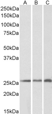Western blot - Anti-CSRP2/Dlp1 antibody (AB65946)