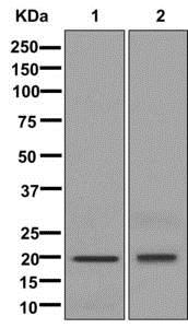 Western blot - Anti-CSRP2/Dlp1 antibody [EPR13164] (AB178695), expandable thumbnail