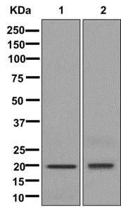 Western blot - Anti-CSRP2/Dlp1 antibody [EPR13164] - BSA and Azide free (AB250069)