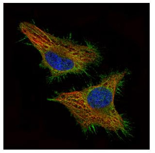 Immunocytochemistry/ Immunofluorescence - Anti-CSRP3 antibody (AB155538), expandable thumbnail