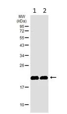 Western blot - Anti-CSRP3 antibody (AB155538)