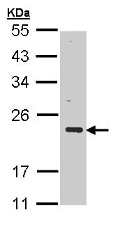 Western blot - Anti-CSRP3 antibody (AB155538), expandable thumbnail