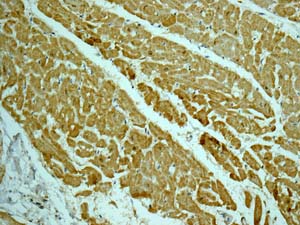 Immunohistochemistry (Formalin/PFA-fixed paraffin-embedded sections) - Anti-CSRP3 antibody [EPR12615(B)] - BSA and Azide free (AB249730), expandable thumbnail