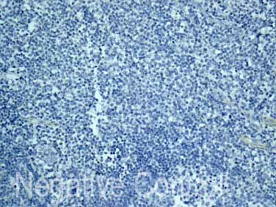Immunohistochemistry (Formalin/PFA-fixed paraffin-embedded sections) - Anti-CSRP3 antibody [EPR12615(B)] - BSA and Azide free (AB249730), expandable thumbnail