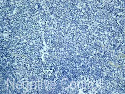 Immunohistochemistry (Formalin/PFA-fixed paraffin-embedded sections) - Anti-CSRP3 antibody [EPR12615(B)] - BSA and Azide free (AB249730)