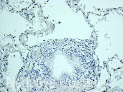 Immunohistochemistry (Formalin/PFA-fixed paraffin-embedded sections) - Anti-CSRP3 antibody [EPR12615(B)] - BSA and Azide free (AB249730), expandable thumbnail