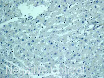 Immunohistochemistry (Formalin/PFA-fixed paraffin-embedded sections) - Anti-CSRP3 antibody [EPR12615(B)] - BSA and Azide free (AB249730)