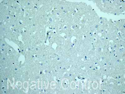 Immunohistochemistry (Formalin/PFA-fixed paraffin-embedded sections) - Anti-CSRP3 antibody [EPR12615(B)] - BSA and Azide free (ab249730), expandable thumbnail