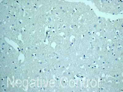 Immunohistochemistry (Formalin/PFA-fixed paraffin-embedded sections) - Anti-CSRP3 antibody [EPR12615(B)] - BSA and Azide free (AB249730)