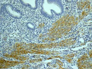 Immunohistochemistry (Formalin/PFA-fixed paraffin-embedded sections) - Anti-CSRP3 antibody [EPR12615(B)] - BSA and Azide free (AB249730)