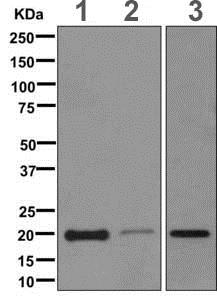 Western blot - Anti-CSRP3 antibody [EPR12615(B)] - BSA and Azide free (AB249730), expandable thumbnail