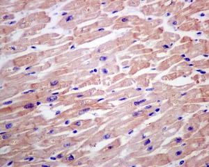 Immunohistochemistry (Formalin/PFA-fixed paraffin-embedded sections) - Anti-CSRP3 antibody [EPR12616(B)] - BSA and Azide free (AB249762), expandable thumbnail