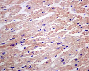 Immunohistochemistry (Formalin/PFA-fixed paraffin-embedded sections) - Anti-CSRP3 antibody [EPR12616(B)] - BSA and Azide free (AB249762)