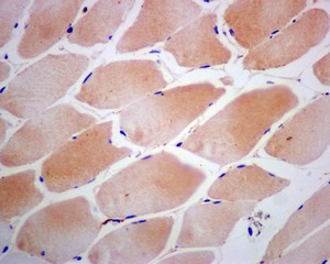 Immunohistochemistry (Formalin/PFA-fixed paraffin-embedded sections) - Anti-CSRP3 antibody [EPR12616(B)] - BSA and Azide free (AB249762), expandable thumbnail