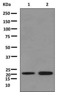 Western blot - Anti-CSRP3 antibody [EPR12616(B)] - BSA and Azide free (AB249762), expandable thumbnail
