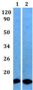 Western blot - Anti-CST6 antibody (AB201088)