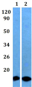 Western blot - Anti-CST6 antibody (AB201088)