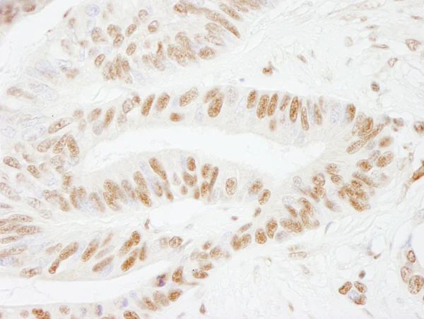 Immunohistochemistry (Formalin/PFA-fixed paraffin-embedded sections) - Anti-CstF-64 antibody (AB72297)