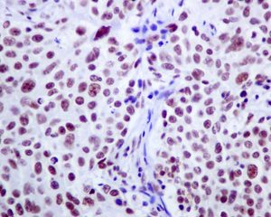 Immunohistochemistry (Formalin/PFA-fixed paraffin-embedded sections) - Anti-CSTF2T + CSTF2 antibody [EPR8924] (AB138486)