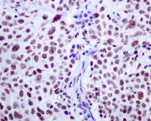 Immunohistochemistry (Formalin/PFA-fixed paraffin-embedded sections) - Anti-CSTF2T + CSTF2 antibody [EPR8924] - BSA and Azide free (AB248842)