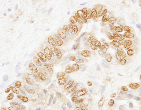 Immunohistochemistry (Formalin/PFA-fixed paraffin-embedded sections) - Anti-CSTF3 antibody (AB72299)
