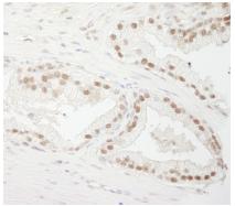 Immunohistochemistry (Formalin/PFA-fixed paraffin-embedded sections) - Anti-CSTF3 antibody (AB74407)