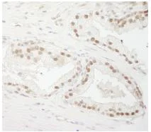 Immunohistochemistry (Formalin/PFA-fixed paraffin-embedded sections) - Anti-CSTF3 antibody (AB74407)