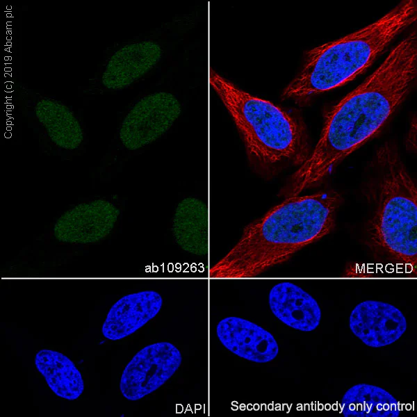 Immunocytochemistry/ Immunofluorescence - Anti-CT A antibody [EPR3940(2)] (AB109263)