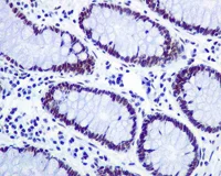 Immunohistochemistry (Formalin/PFA-fixed paraffin-embedded sections) - Anti-CT A antibody [EPR3940(2)] (AB109263)