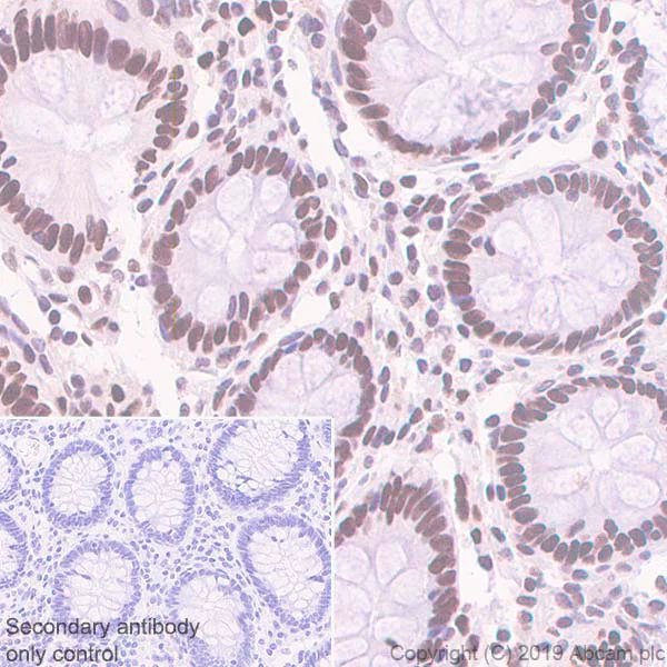 Immunohistochemistry (Formalin/PFA-fixed paraffin-embedded sections) - Anti-CT A antibody [EPR3940(2)] (AB109263)