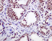 Immunohistochemistry (Formalin/PFA-fixed paraffin-embedded sections) - Anti-CT A antibody [EPR3940(2)] (AB109263)
