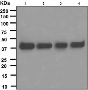 Western blot - Anti-CT A antibody [EPR3940(2)] (AB109263)
