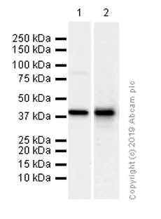 Western blot - Anti-CT A antibody [EPR3940(2)] (AB109263)