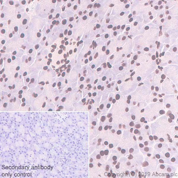 Immunohistochemistry (Formalin/PFA-fixed paraffin-embedded sections) - Anti-CT A antibody [EPR3940(2)] - BSA and Azide free (AB247811)