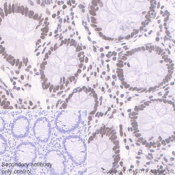 Immunohistochemistry (Formalin/PFA-fixed paraffin-embedded sections) - Anti-CT A antibody [EPR3940(2)] - BSA and Azide free (AB247811), expandable thumbnail