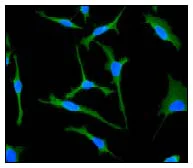 Immunocytochemistry/ Immunofluorescence - Anti-CT A antibody [EPR3941] (AB92440)