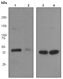 Western blot - Anti-CT A antibody [EPR3941] - BSA and Azide free (AB247553)