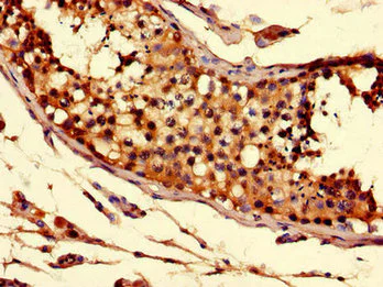 Immunohistochemistry (Formalin/PFA-fixed paraffin-embedded sections) - Anti-CT054 antibody (AB223094)