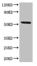 Western blot - Anti-CT054 antibody (AB223094)