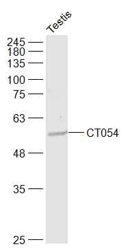 Western blot - Anti-CT054 antibody - C-terminal (AB214232)