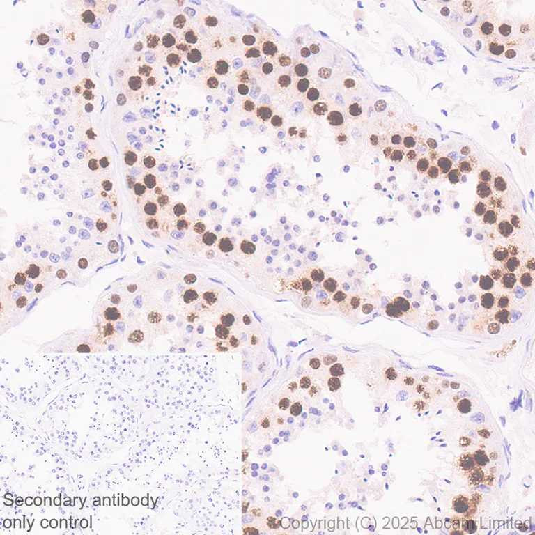 Immunohistochemistry (Formalin/PFA-fixed paraffin-embedded sections) - Anti-CT45 antibody [EPR29691-71] (AB323553)