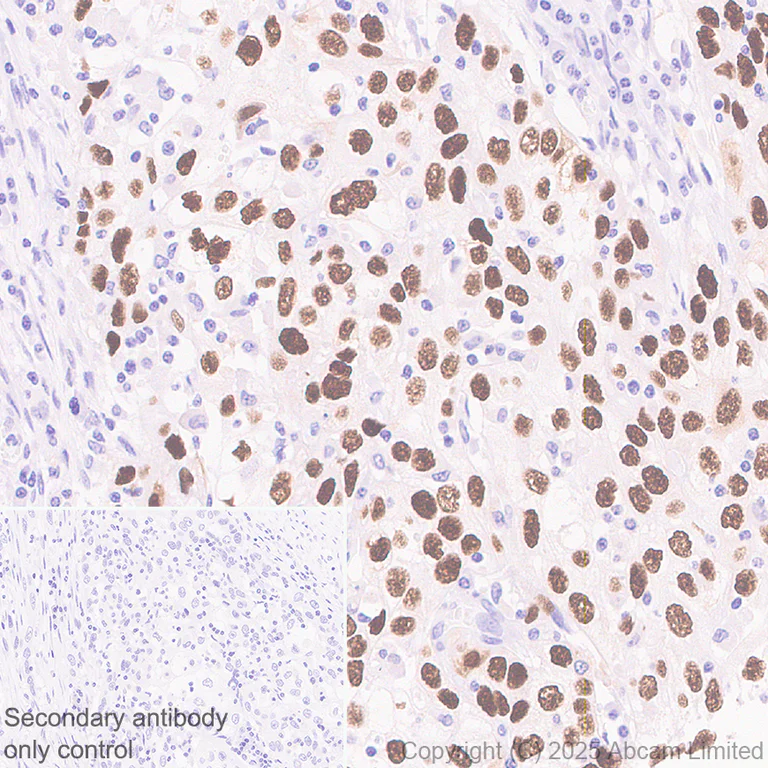 Immunohistochemistry (Formalin/PFA-fixed paraffin-embedded sections) - Anti-CT45 antibody [EPR29691-71] (AB323553)