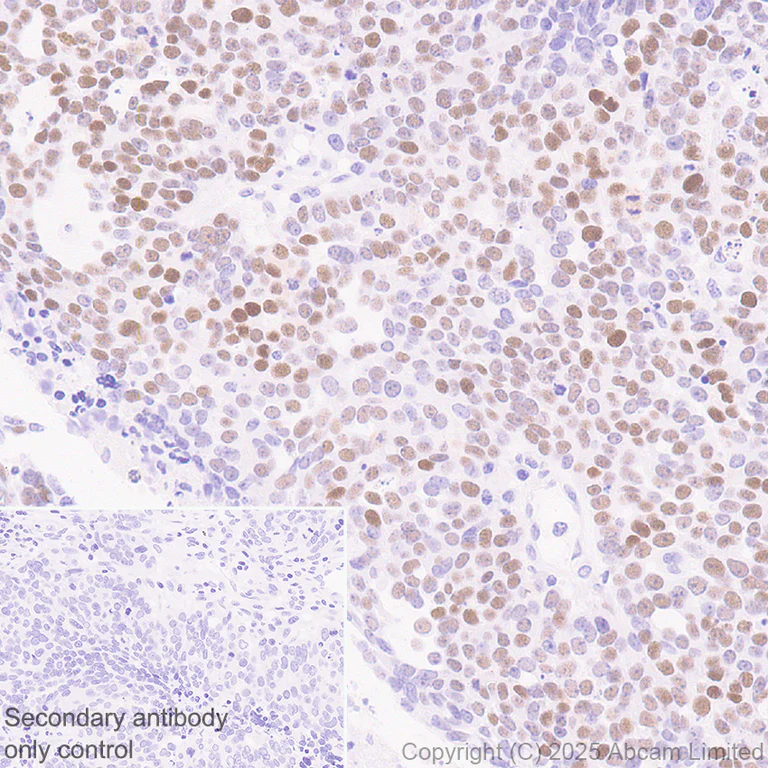 Immunohistochemistry (Formalin/PFA-fixed paraffin-embedded sections) - Anti-CT45 antibody [EPR29691-71] (AB323553)