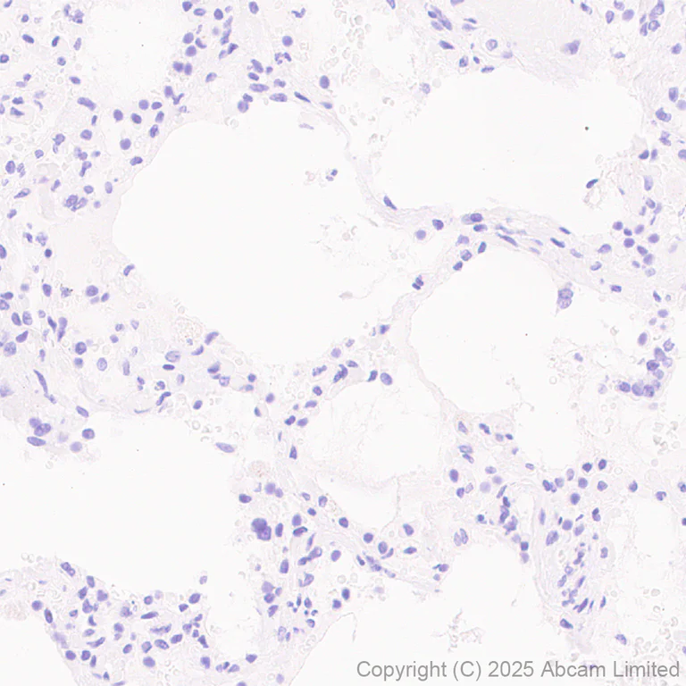 Immunohistochemistry (Formalin/PFA-fixed paraffin-embedded sections) - Anti-CT45 antibody [EPR29691-71] (AB323553)