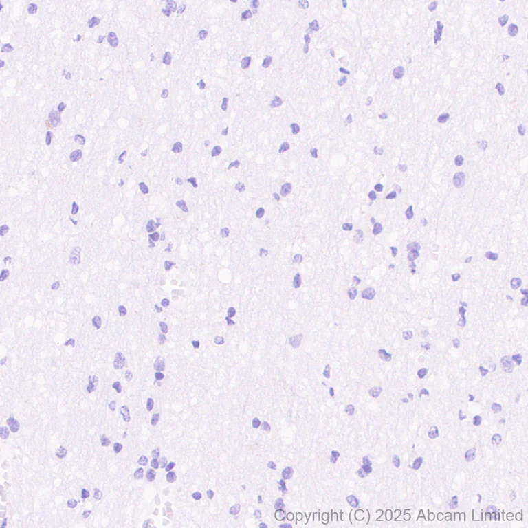 Immunohistochemistry (Formalin/PFA-fixed paraffin-embedded sections) - Anti-CT45 antibody [EPR29691-71] (AB323553)
