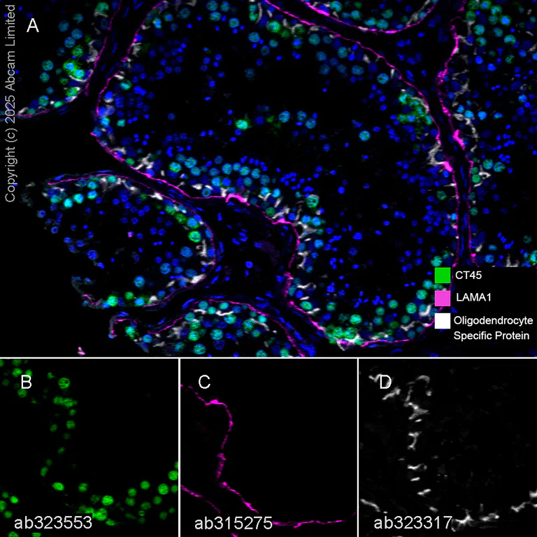 Multiplex immunohistochemistry - Anti-CT45 antibody [EPR29691-71] (AB323553)