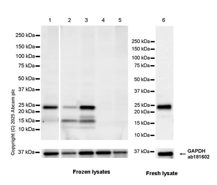 Western blot - Anti-CT45 antibody [EPR29691-71] (AB323553)
