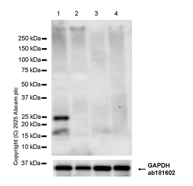 Western blot - Anti-CT45 antibody [EPR29691-71] (AB323553)
