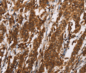 Immunohistochemistry (Formalin/PFA-fixed paraffin-embedded sections) - Anti-CTAG1B antibody (AB198878)